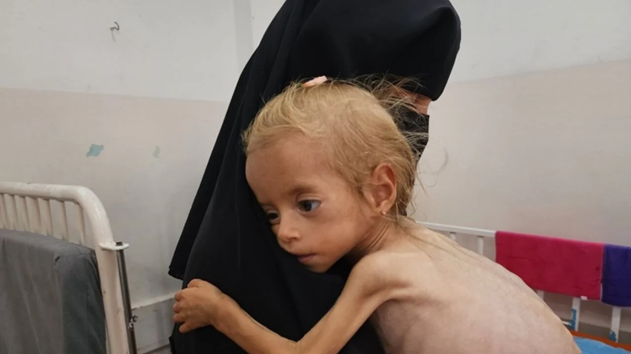 İsrail'in Gazze ablukası altında açlık nedeniyle ölümler artıyor