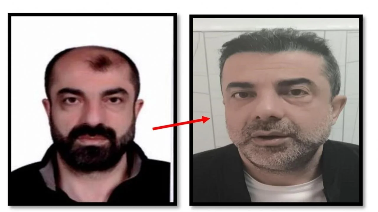 Ameliyat ile yüzünü değiştiren firari cinayet zanlısı yakalandı