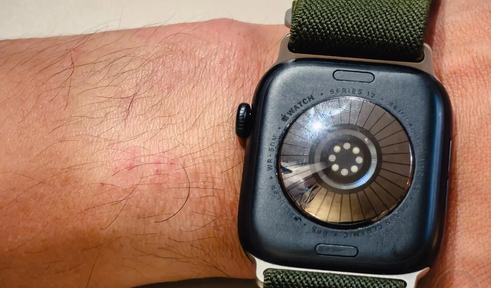 Apple Watch Series 12'de bilek tahrişi iddiaları! Açıklama geldi