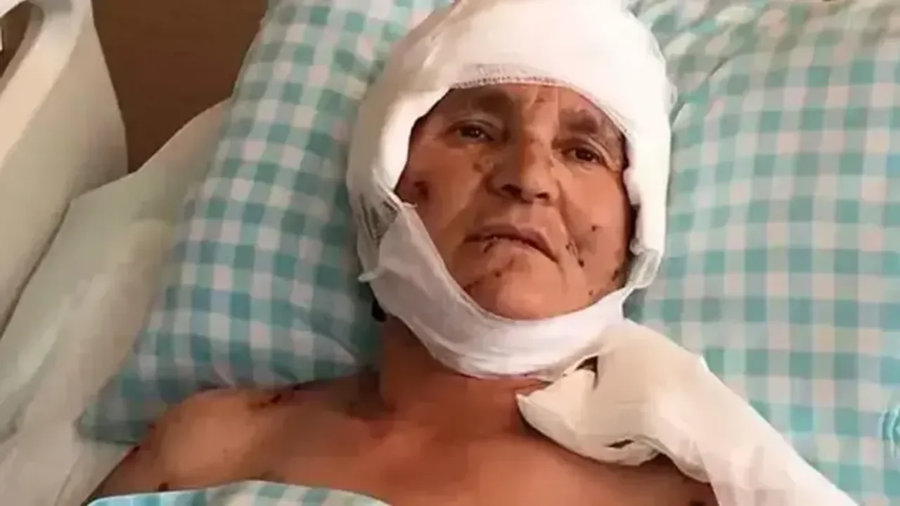 Kırşehir’deki Emsal Köpek Saldırısı Davasında Verilen Ağır Tazminat Kararı